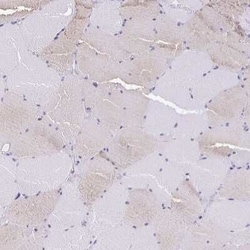 ARPP-21 Antibody, Novus Biologicals 25 &mu;L; Unconjugated:Antibodies,
