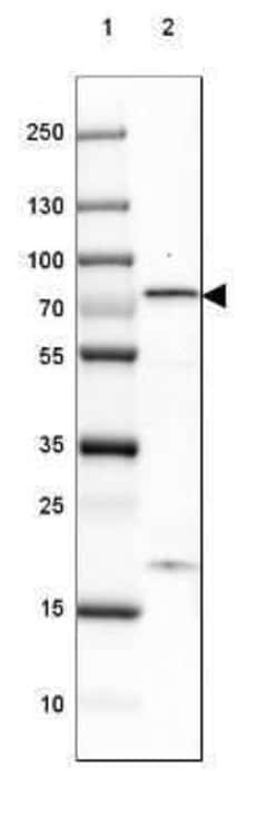 ARPP-21 Antibody, Novus Biologicals 25 &mu;L; Unconjugated:Antibodies,