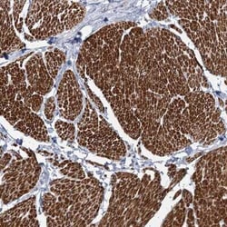 ARSI Antibody, Novus Biologicals:Antibodies:Primary Antibodies