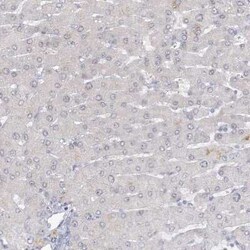 ARSI Antibody, Novus Biologicals:Antibodies:Primary Antibodies
