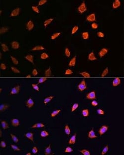 ART1 Antibody - BSA Free, Novus Biologicals:Antibodies:Primary Antibodies