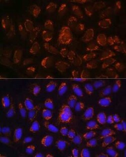 ART1 Antibody - BSA Free, Novus Biologicals:Antibodies:Primary Antibodies