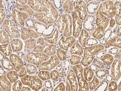 ART1 Antibody, Novus Biologicals 100 &mu;g, Unconjugated:Antibodies, Polyclonal