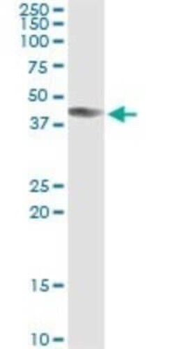 ART3 Antibody (1D2), Novus Biologicals 0.1 mg | Buy Online | Novus Biologicals | Fisher Scientific