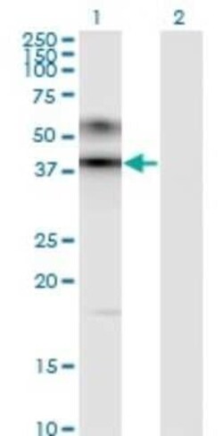 ART3 Antibody (1D2), Novus Biologicals 0.1 mg | Buy Online | Novus Biologicals | Fisher Scientific