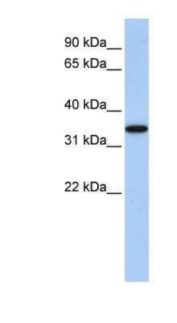 Novus Biologicals ART4 Antibody, Novus Biologicals 100 &mu;L; Unconjugated:Antibodies,