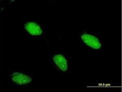 ARX Antibody (1G11), Novus Biologicals 0.1 mg; Unconjugated:Antibodies,
