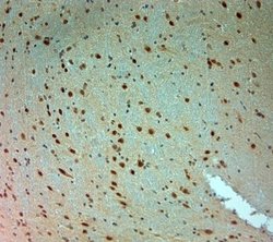 ARX Antibody, Novus Biologicals 0.1 mL; Unconjugated:Antibodies, Polyclonal