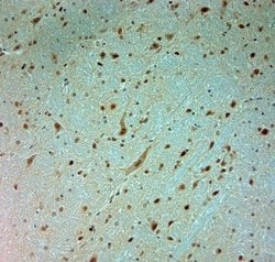 ARX Antibody, Novus Biologicals 0.1 mL; Unconjugated:Antibodies, Polyclonal