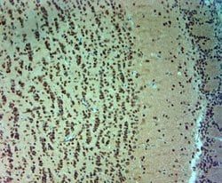 ARX Antibody, Novus Biologicals 0.1 mL; Unconjugated:Antibodies, Polyclonal