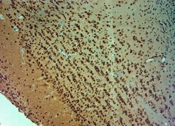 ARX Antibody, Novus Biologicals 0.1 mL; Unconjugated:Antibodies, Polyclonal