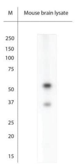 ARX Antibody, Novus Biologicals 0.1 mL; Unconjugated:Antibodies, Polyclonal