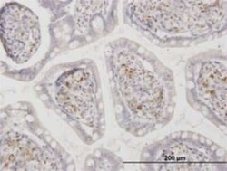 ASAH1 Antibody (1A7), Novus Biologicals 0.1 mg | Buy Online | Novus Biologicals | Fisher Scientific