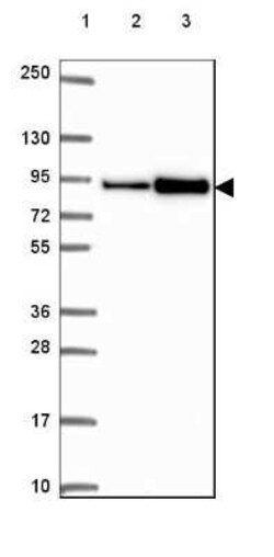 ASAH2/N-acylsphingosine Amidohydrolase-2 Antibody, Novus Biologicals 25