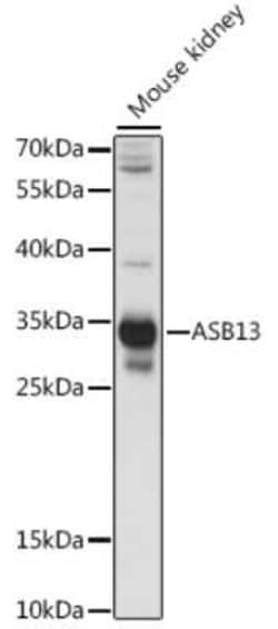 ASB13 Antibody - Azide and BSA Free, Novus Biologicals 0.02 mL | Buy Online | Novus Biologicals | Fisher Scientific