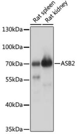 ASB2 Antibody - Azide and BSA Free, Novus Biologicals:Antibodies:Primary