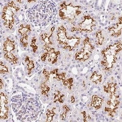 ASB4 Antibody, Novus Biologicals 25 &mu;L, Unconjugated:Antibodies, Polyclonal