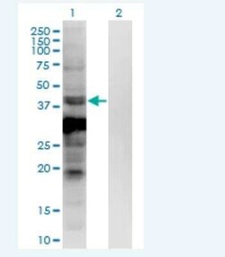 ASB5 Antibody (6B10), Novus Biologicals 100 &mu;g; Unconjugated:Antibodies,