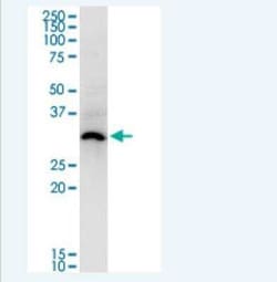 ASB5 Antibody (6B10), Novus Biologicals 100 &mu;g; Unconjugated:Antibodies,