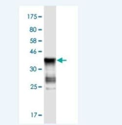 ASB5 Antibody (6B10), Novus Biologicals 100 &mu;g; Unconjugated:Antibodies,