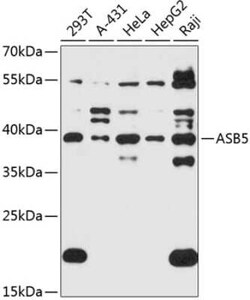 ASB5 Antibody - Azide and BSA Free, Novus Biologicals:Antibodies:Primary