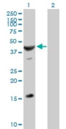 ASB6 Antibody, Novus Biologicals 0.05 mg | Buy Online | Novus Biologicals | Fisher Scientific