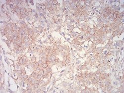 ASC/TMS1 Antibody (1C3D3) - BSA Free, Novus Biologicals:Antibodies:Primary