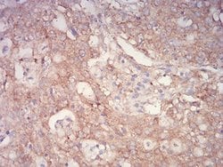 ASC/TMS1 Antibody (1C3D7) - BSA Free, Novus Biologicals 0.1 ml; Unconjugated:Antibodies,