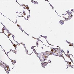 ASC/TMS1 Antibody, Novus Biologicals:Antibodies:Primary Antibodies