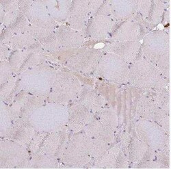 ASC/TMS1 Antibody, Novus Biologicals:Antibodies:Primary Antibodies