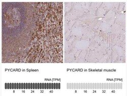 ASC/TMS1 Antibody, Novus Biologicals:Antibodies:Primary Antibodies