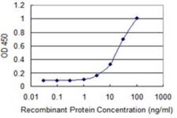 ASCC2 Antibody (3B2), Novus Biologicals 0.1 mg; Unconjugated:Antibodies,