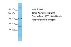 ASCC3L1 Antibody, Novus Biologicals 100 &mu;L | Buy Online | Novus Biologicals | Fisher Scientific