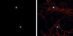 ASCL1/Mash1 Antibody, Novus Biologicals 100 μg; Unconjugated:Antibodies,