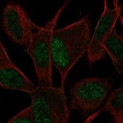 ASCL1/Mash1 Rabbit anti-Human, Polyclonal, Novus Biologicals 25 &mu;g;