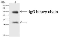ASCL1/Mash1 Antibody, Novus Biologicals 50 &mu;g; Unconjugated:Antibodies,