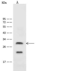 ASCL1/Mash1 Antibody, Novus Biologicals 50 &mu;g; Unconjugated:Antibodies,