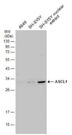 ASCL1/Mash1 Antibody, Novus Biologicals 100 μg; Unconjugated:Antibodies,