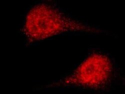 ASF1a Antibody, Novus Biologicals 50 &mu;g, Unconjugated:Antibodies, Polyclonal