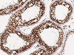ASF1b Rabbit anti-Human, Clone: 2, Novus Biologicals:Antibodies:Primary