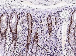 ASF1b Rabbit anti-Human, Clone: 2, Novus Biologicals:Antibodies:Primary