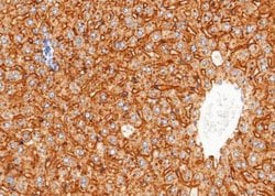 ASGPR1 Rabbit anti-Mouse, Clone: 114, Novus Biologicals:Antibodies:Primary