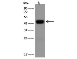 ASGPR1 Rabbit anti-Human, Clone: 24, Novus Biologicals 100 &mu;g; Unconjugated:Antibodies,