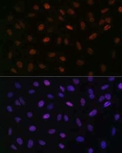 ASH2L Rabbit anti-Human, Mouse, Rat, Clone: 10B6U5, Novus Biologicals 100