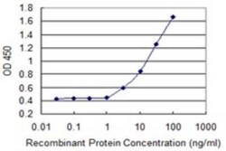 ASMT Antibody (1F8), Novus Biologicals 0.1 mg, Unconjugated:Antibodies,