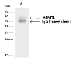 ASMTL Antibody, Novus Biologicals 100 &mu;g, Unconjugated:Antibodies, Polyclonal