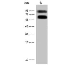 ASMTL Antibody, Novus Biologicals 100 &mu;g, Unconjugated:Antibodies, Polyclonal
