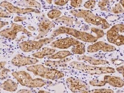 ASPA Antibody, Novus Biologicals 50 &mu;g, Unconjugated:Antibodies, Polyclonal