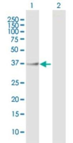 ASPHD1 Antibody, Novus Biologicals 50 &mu;g; Unconjugated:Antibodies, Polyclonal