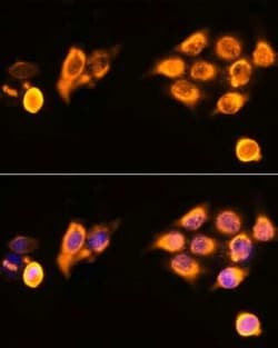 ASPM Antibody - Azide and BSA Free, Novus Biologicals 0.02 mL, Unconjugated:Antibodies,